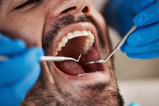 Best Emergency Wisdom Teeth Removal in Las Palmas Ii, TX